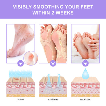 Exfoliating Foot Mask Feet Cream For Dead Skin Removal Foot Care Tool Removing Dead Skin Foot Peeling Whitening Foot